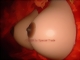 Sexy pair of false breasts