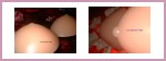 silicone-breast-forms-cup-a-inexpensive.jpg
