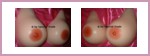 silicone-breasts-asymmetrical-inexpensive.jpg